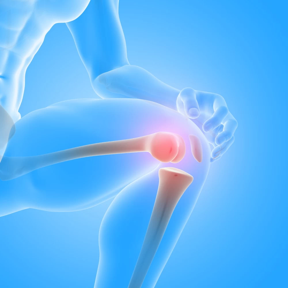 orthopaedic products suppliers