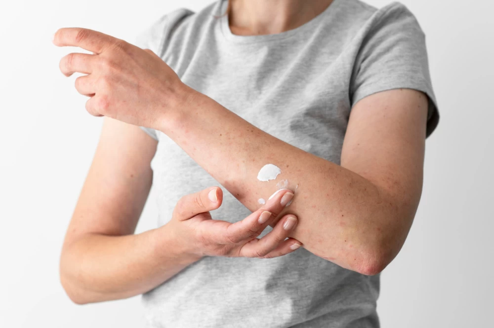 antifungal cream product company
