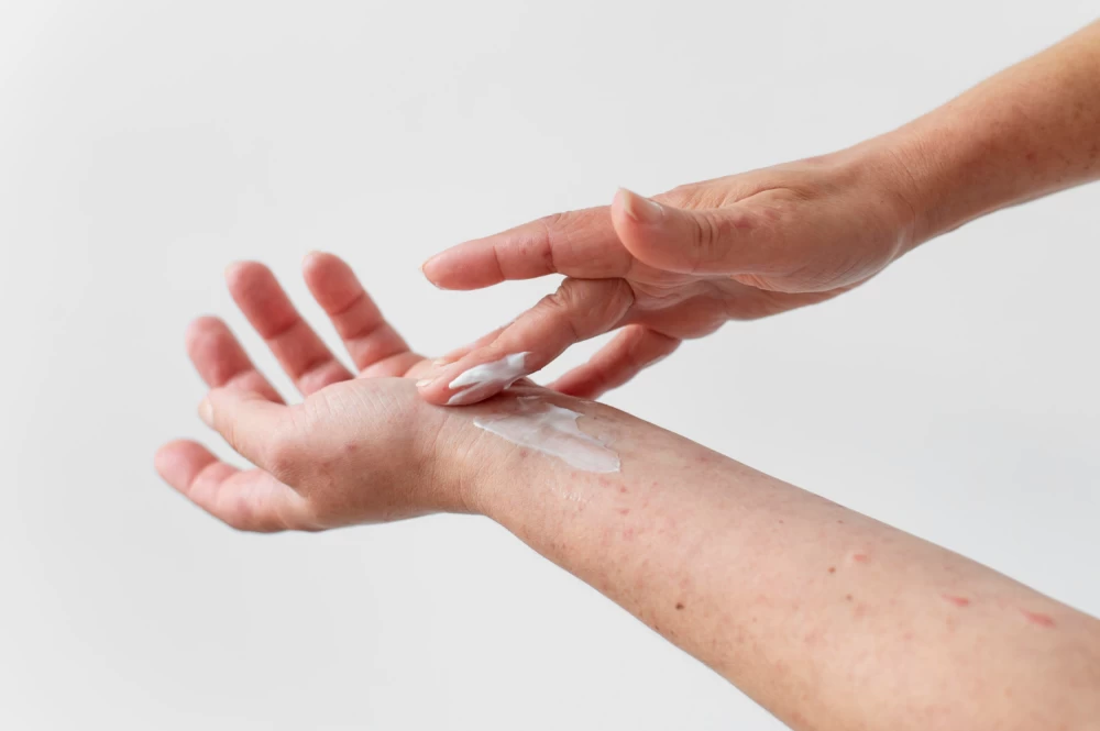 antifungal ointments